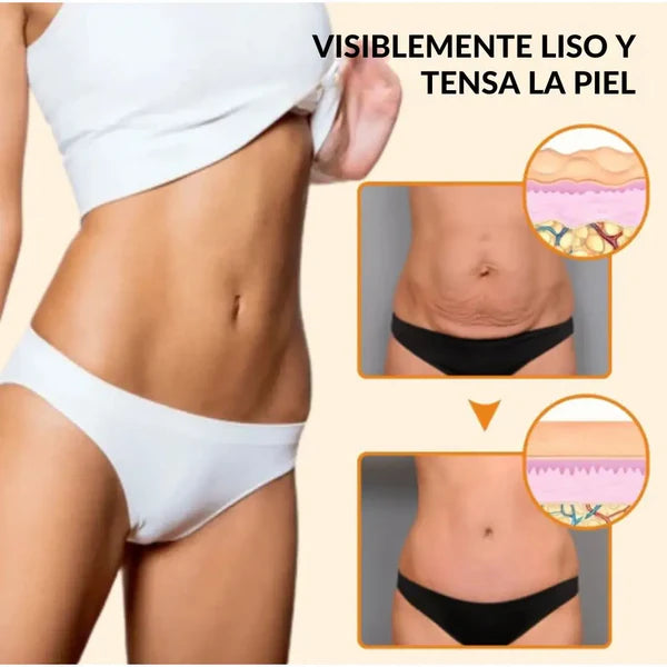 🔥2X1 Nueva Formula Mejorada Antiestrías Skinrepair® - Compra 1 y llévate 2🔥