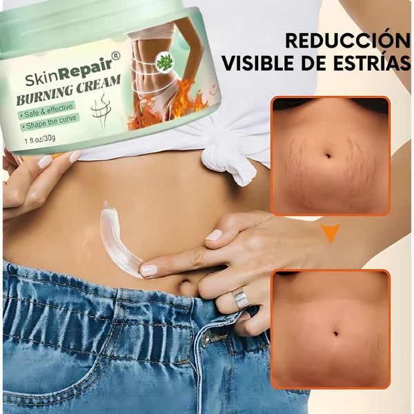 🔥2X1 Nueva Formula Mejorada Antiestrías Skinrepair® - Compra 1 y llévate 2🔥