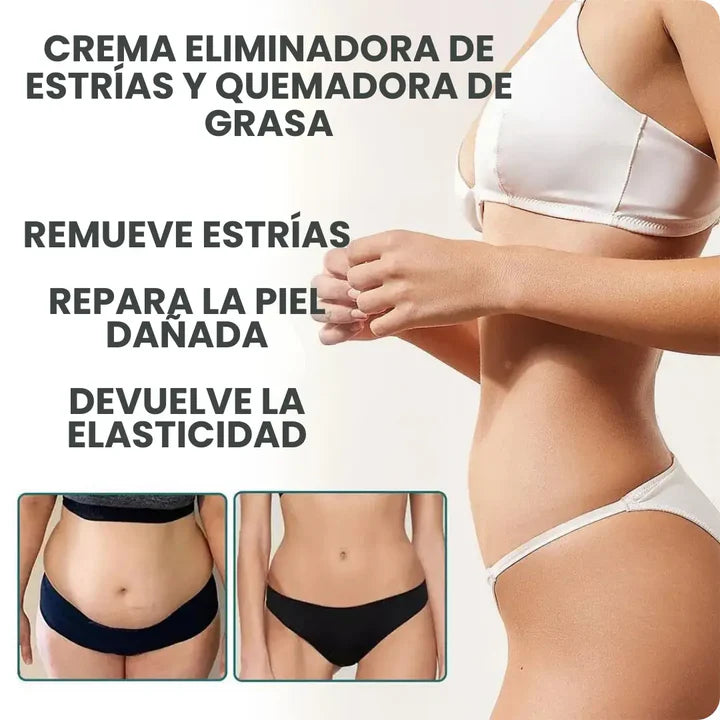 🔥2X1 Nueva Formula Mejorada Antiestrías Skinrepair® - Compra 1 y llévate 2🔥