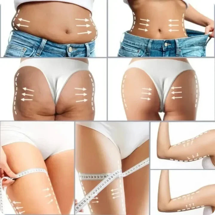 🔥2X1 Nueva Formula Mejorada Antiestrías Skinrepair® - Compra 1 y llévate 2🔥