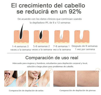 🛸Depiladora Laser IPL PRO™ Permanente🥰