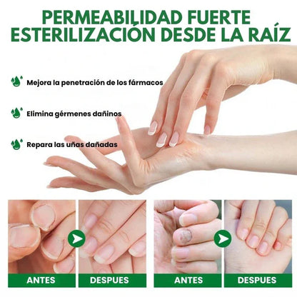 👋🦠Anti Hongos Uñas - German Toenail Plus™  2UND 30ml