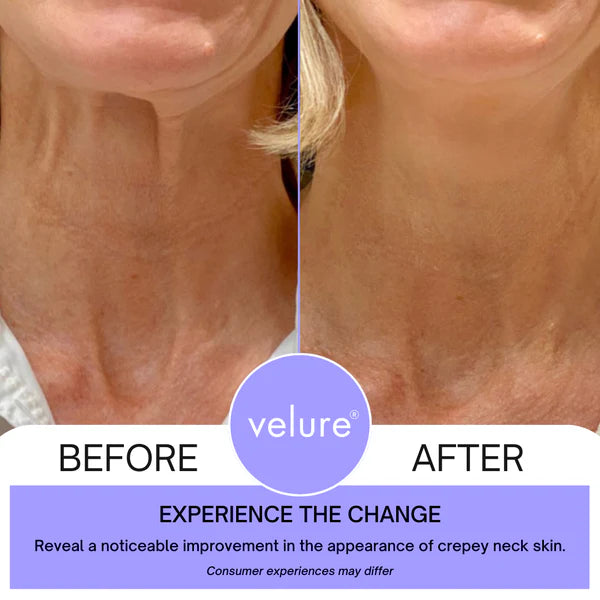 💜2x1 Neck Cream® Reafirmante Antienvejecimiento-Compra 1 y llévate 2💜
