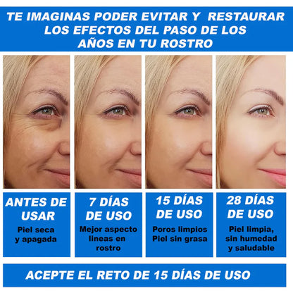 2xBotox Stock Solution💧 Serum Antiarruga 2 por 1